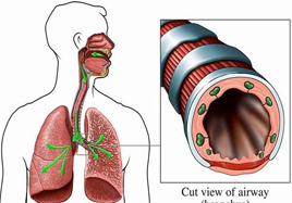 寒冬支氣管炎的高發(fā)期 補(bǔ)硒安全過冬