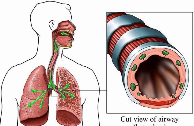 支氣管補(bǔ)硒